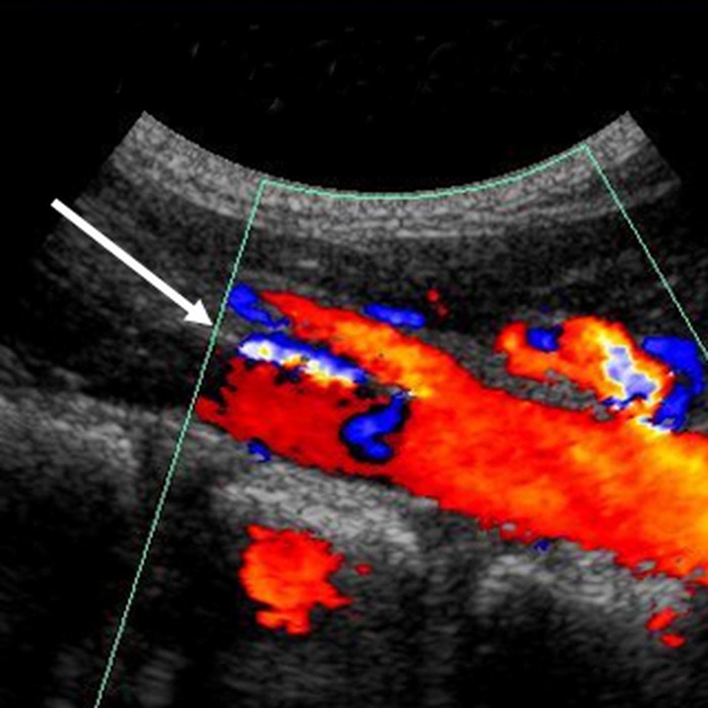 ecocolorodoppler3.jpg